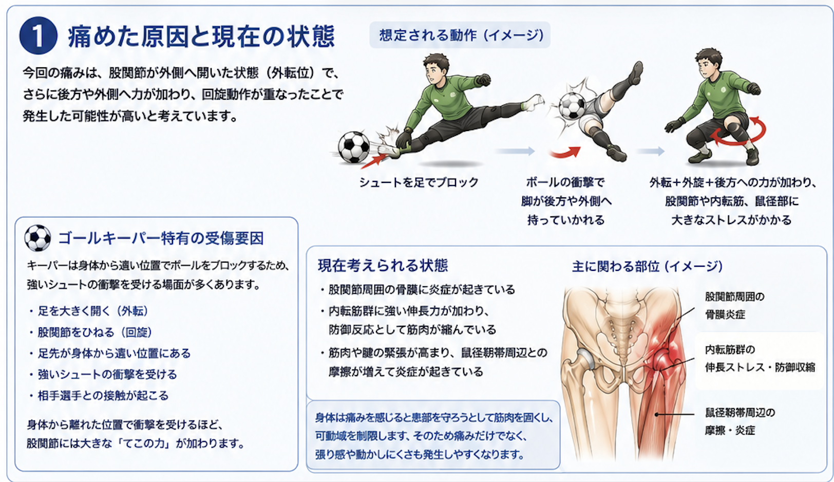 サポート画像
