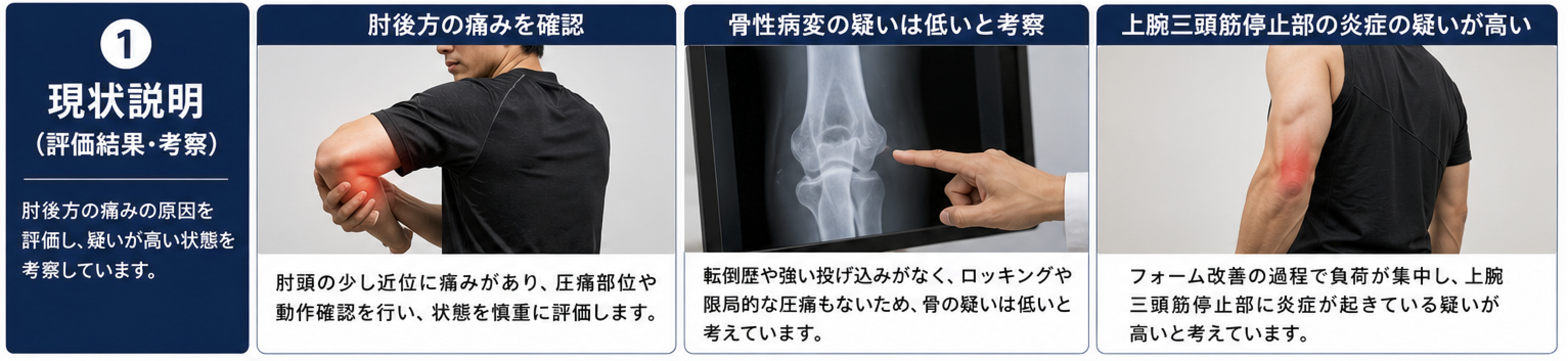 サポート画像